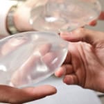 Breast Augmentation
