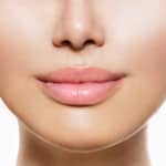Nose Surgery