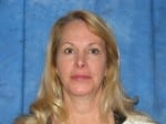 Laser Facelift with PrecisionTx
