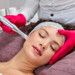 Beautiful woman receiving microneedling rejuvenation treatment