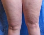 Cellulaze
